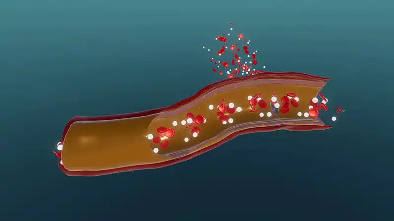 Blood clotting